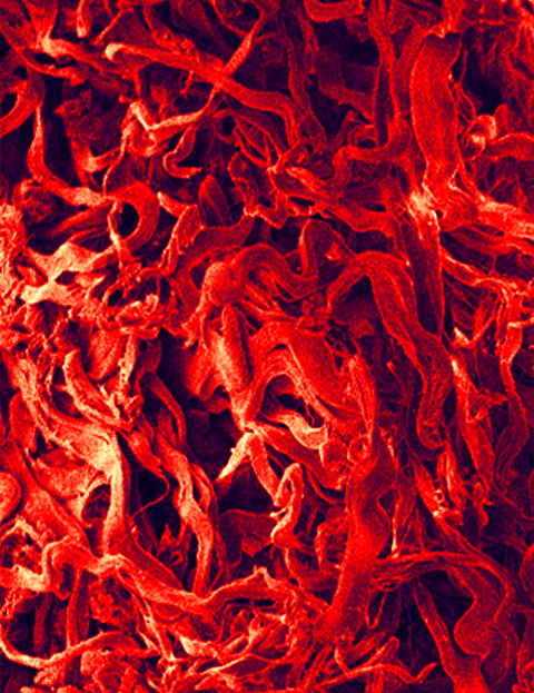 SEM image of arrangement of curved collagen fibres.
