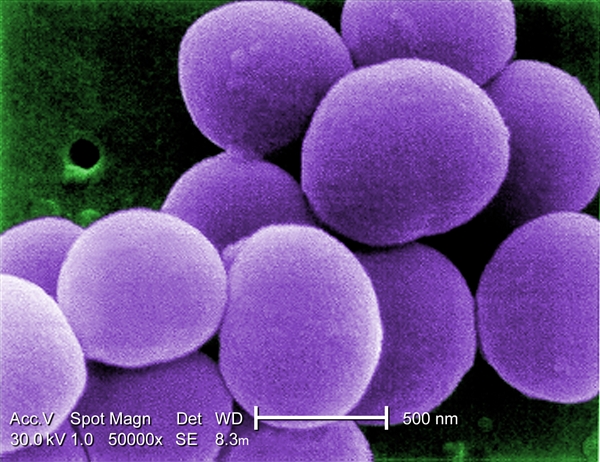 Antibiotic-resistant Staphylococcus aureus bacteria, or grapes, what do I know